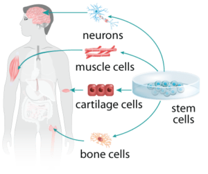 Stem cell treatment diagram